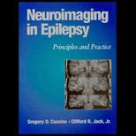 Neuroimaging in Epilepsy  Principles and Practice