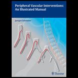 Peripheral Vascular Interventions