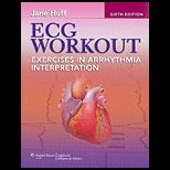 ECG Workout Exer. in Arrhythmia Interp.