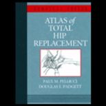 Atlas of Total Hip Replacement