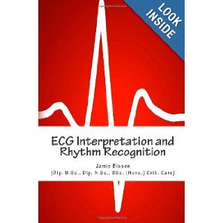 ECG Interpretation and Rhythm Recognition Mr Jamie Bisson, Dr Peter Fletcher, Dr Cafer Zorkun, Prof Chirk Jenn 9781479339686 Books