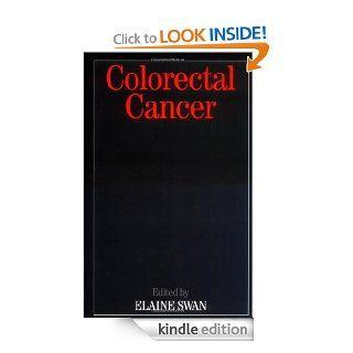 Colorectal Cancer eBook Elaine Swan Kindle Store