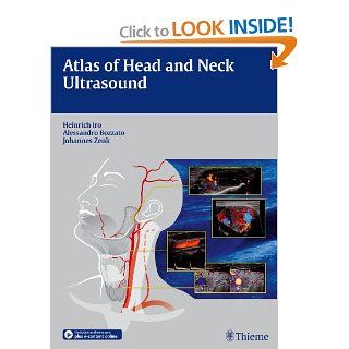 Atlas of Head and Neck Ultrasound (9783131603517) Heinrich Iro, Alessandro Bozzato, Johannes Zenk Books
