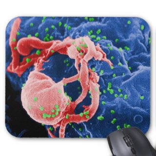 Electron Micrograph of HIV 1 Budding Lymphocyte Mouse Pads