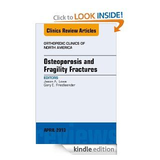 Osteoporosis and Fragility Fractures, An Issue of Orthopedic Clinics, (The Clinics Orthopedics) eBook Jason A. Lowe, Gary E. Friedlaender Kindle Store