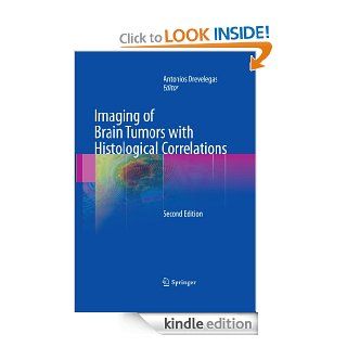 Imaging of Brain Tumors with Histological Correlations eBook Antonios (Ed.) Drevelegas, Antonios Drevelegas Kindle Store