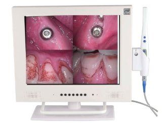 Dental Intraoral Camera Endoscope Mouth Exam WI FI Intra Oral Cam Corded with 15 Inch Monitor M 958A Health & Personal Care