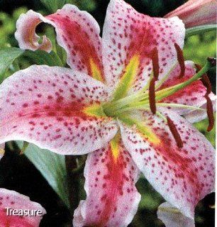 Treasure Oriental Lily 2 Bulbs   Pink & Dark Red Spots  Lily Plants  Patio, Lawn & Garden