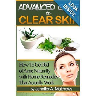 Advanced Guide to Clear Skin How To Get Rid of Acne Naturally with Home Remedies That Actually Work Jennifer A Matthews 9781468181012 Books