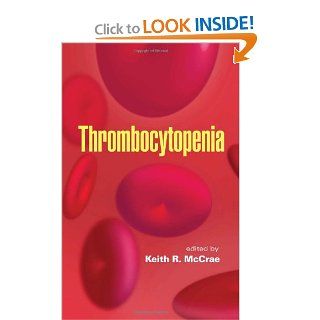 Thrombocytopenia (Basic and Clinical Oncology) Keith R. McCrae 9781845694180 Books