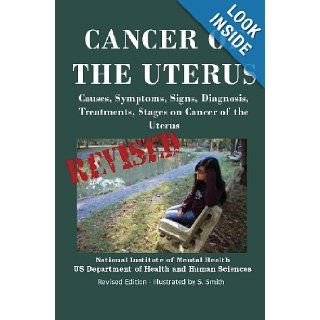 Cancer Of The Uterus Causes, Symptoms, Signs, Diagnosis, Treatments, Stages Of Cancer of the Uterus   Revised Edition   Illustrated by S. Smith Department of Health and Human Services, National Institutes of Health, National Cancer Institute, S. Smith 9