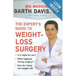The Expert's Guide to Weight Loss Surgery Is it right for me? What happens during surgery? How do I keep the weight off? Garth Davis 9781594630521 Books