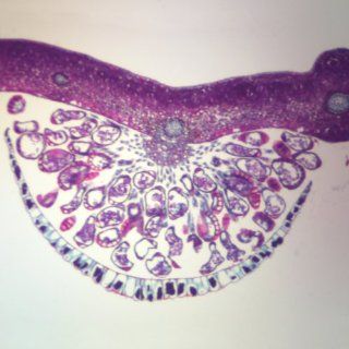 Fern Young Sporangia, c.s., 12 µm Microscope Slide
