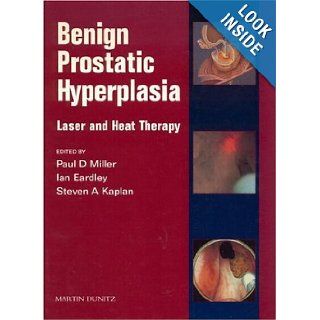 Benign Prostatic Hyperplasia Laser and Heat Therapies Ian Eardley, Steven A. Kaplan, Paul D. Miller 9781853175343 Books