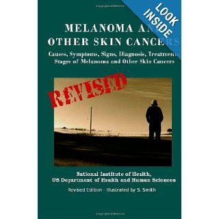 Melanoma And Other Skin Cancers Causes, Symptoms, Signs, Diagnosis, Treatments, Stages of Melanoma and Other Skin Cancers U.S. Department of Health and Human Services, National Institute of Health, National Cancer Institute, S. Smith 9781475017274 Book