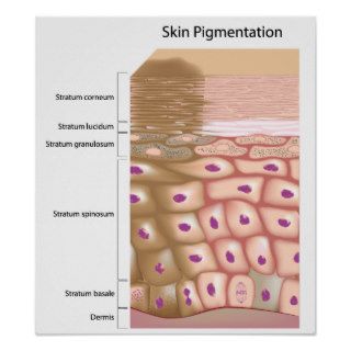 Formation of uneven skin tone Poster