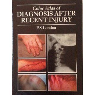 Colour Atlas of Diagnosis After Recent Injury P. S. London 9780801662959 Books
