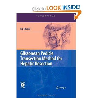Glissonean Pedicle Transection Method for Hepatic Resection 9784431489436 Medicine & Health Science Books @