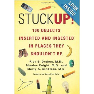 Stuck Up 100 Objects Inserted and Ingested in Places They Shouldn't Be Rich E. Dreben, Murdoc Knight, Marty A. Sindhian 9780312680084 Books